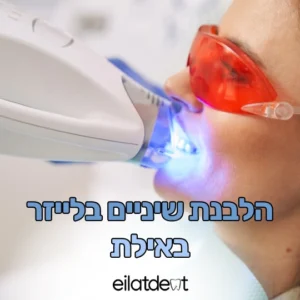 הלבנת שיניים בלייזר באילת — מחיר, יתרונות וכל מה שצריך לדעת